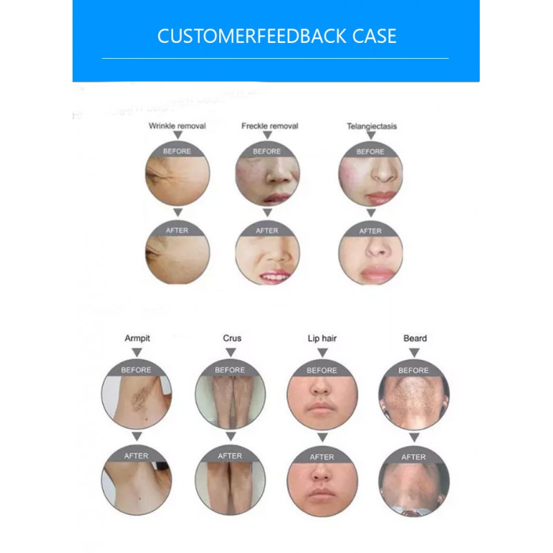 4 in 1 Vertical Professional IPL Machine Laser Magneto OPT Spot Size IPL YAG Laser Hair Removal Machine 