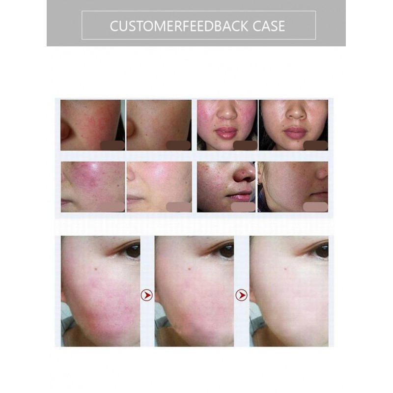 New Technology 4 IN 1 OPT IPL Hair Removal Painless hair removal and magnetic skin rejuvenation beauty machine 