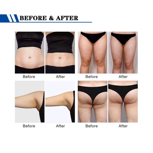 Factory price HIEMT EMSLIM Neo Sculpt muscle building and body sculpting Machine with 4 applicators for Sale