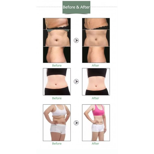 Vela Boby Shape Standing Beauty Machine Fat Burning Skin Lifting Roller Face Massage Device Fat Removal Feet Hands Machine