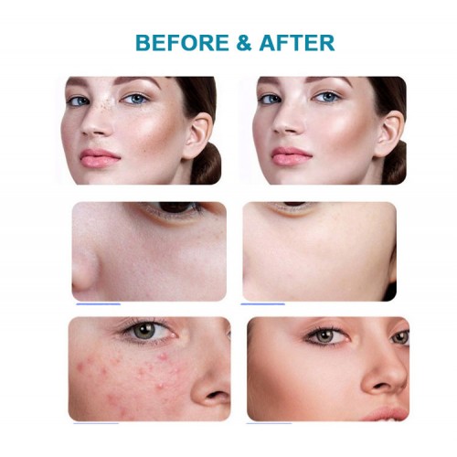 Professional LED Photon Beauty Machine LED Photodynamic Red Blue Yellow Green Infrared Light Treatment Acne Device